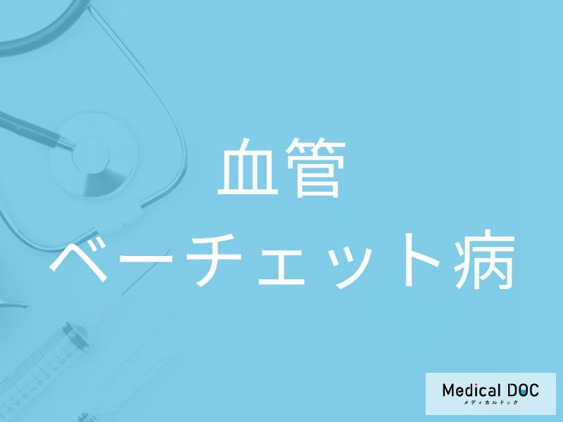 血管ベーチェット病