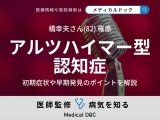 歌手・橋幸夫「アルツハイマー型認知症」を発症 初期症状や早期発見のポイントを医師が解説