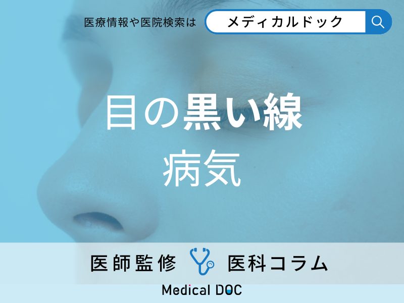 目の黒い線 病気