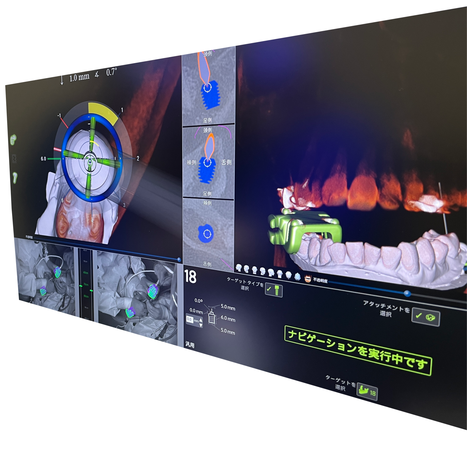 ハートフル歯科 南口院