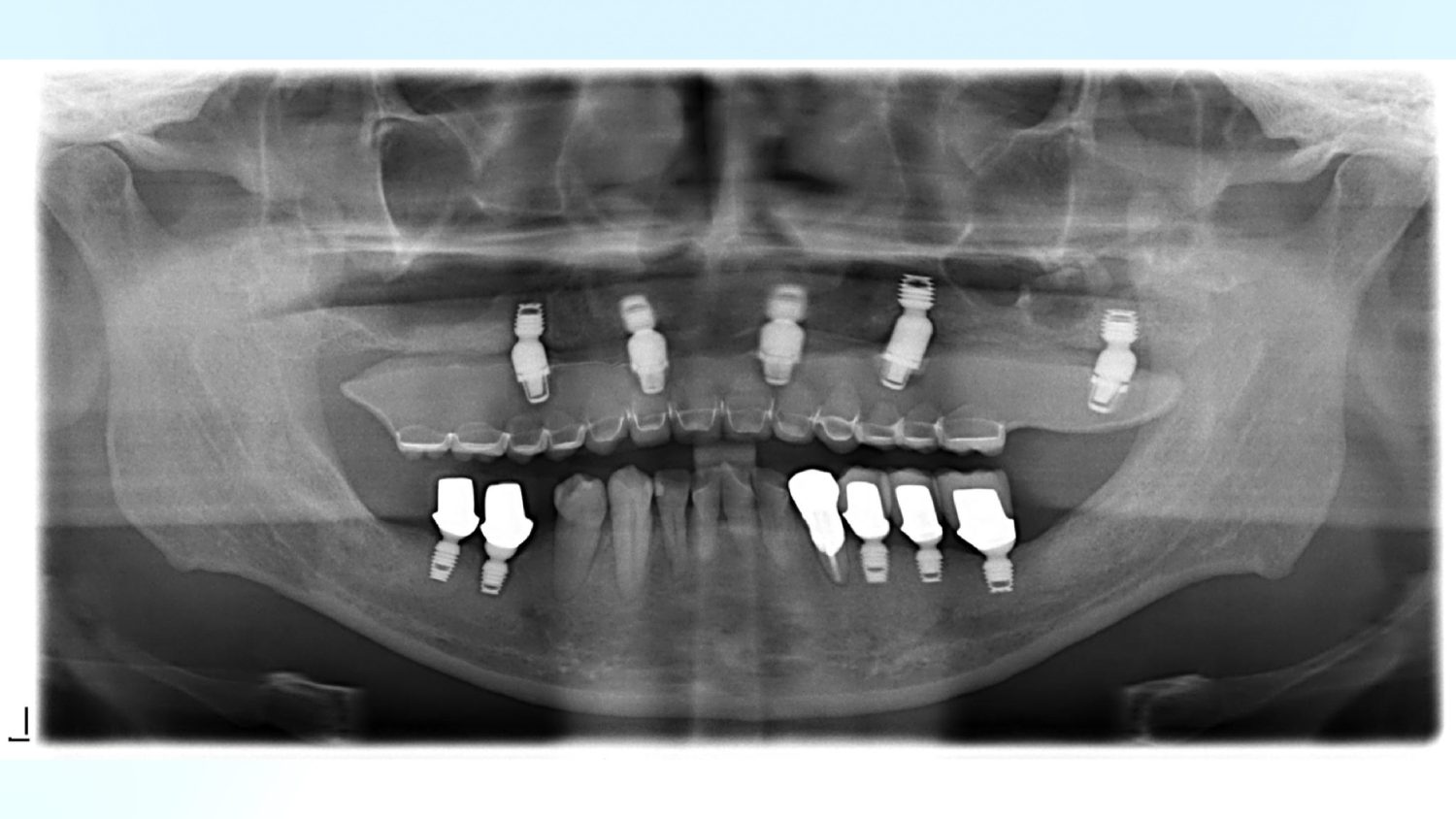 ハートフル歯科 南口院