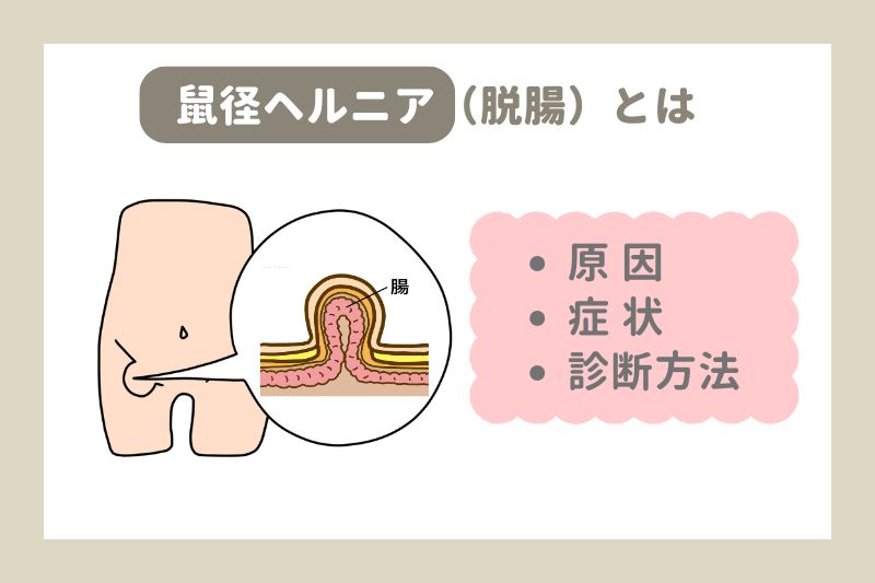 鼠径ヘルニア（脱腸）とは
