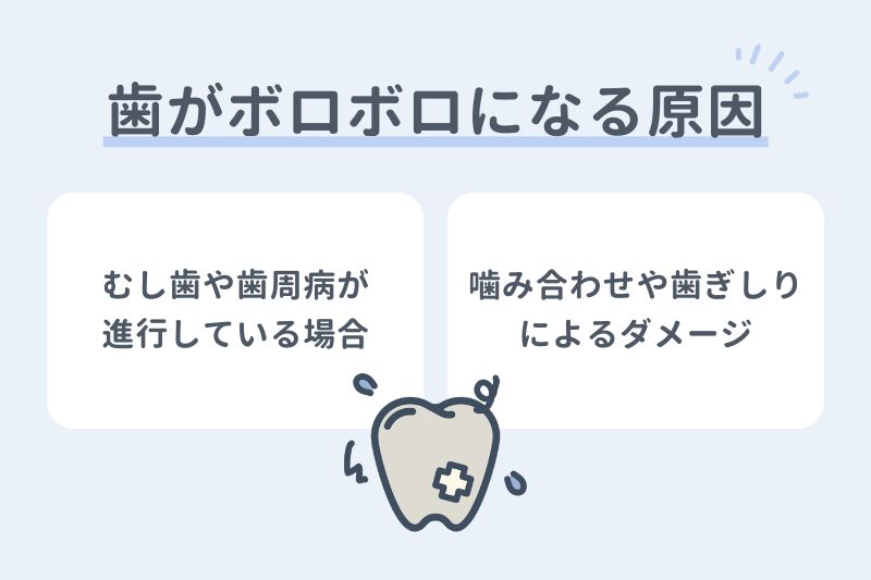 歯がボロボロになる原因
