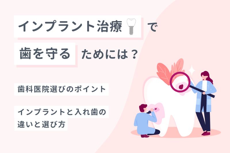 インプラント治療で歯を守る