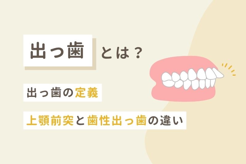 出っ歯とは