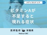 非公開: 「ビタミンAが不足すると現れる症状」はご存知ですか？不足する原因も解説！
