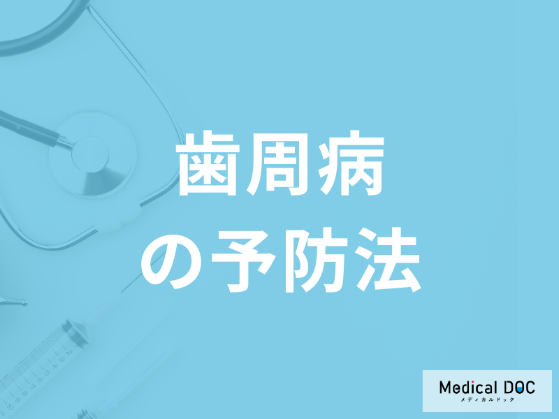 「歯周病の予防法」はご存知ですか？受診の目安となる症状も医師が解説！
