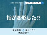女性に多い｢ヘバーデン結節｣＆｢ブシャール結節｣の症状･治療法を医師が解説