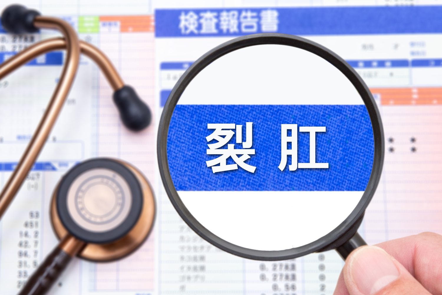 裂肛とは？