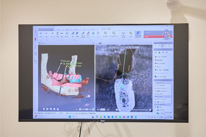 うえほんまちかづ歯科口腔外科photo