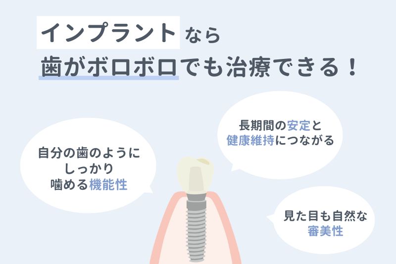 インプラントなら歯がボロボロでも治療できる！