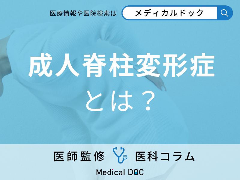 成人脊柱変形症とは?