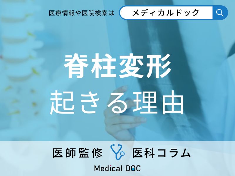 背骨が曲がる「成人脊柱変形」閉経後の女性に急増する原因とは？【医師解説】
