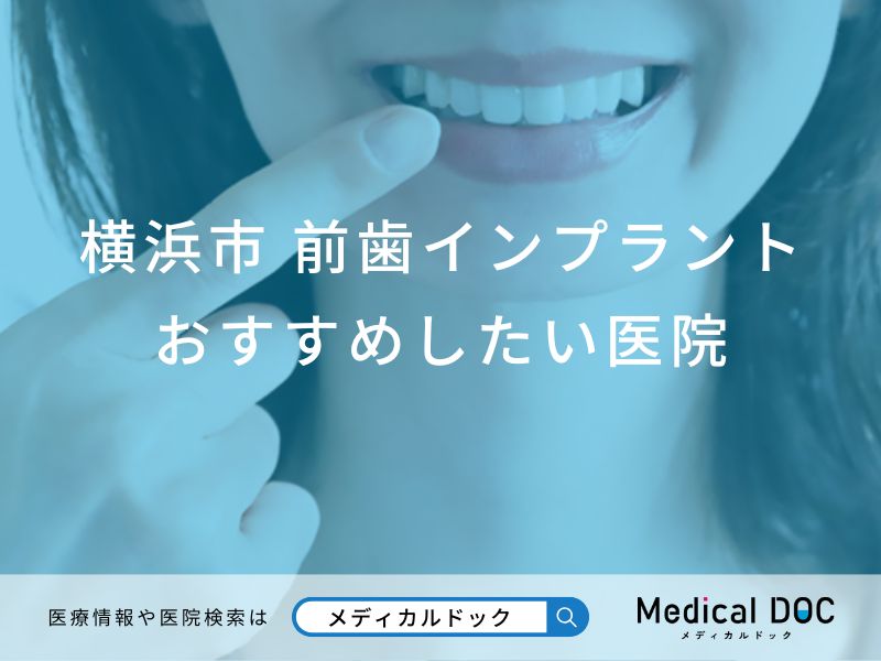 横浜市 前歯のインプラント治療