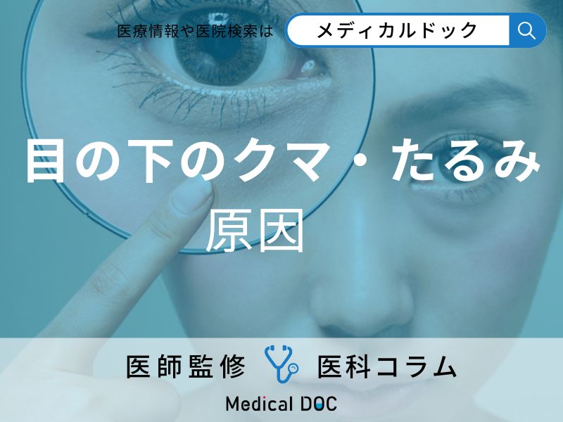 目の下のクマ・たるみの原因