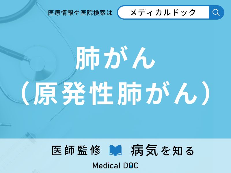 肺がん（原発性肺がん）