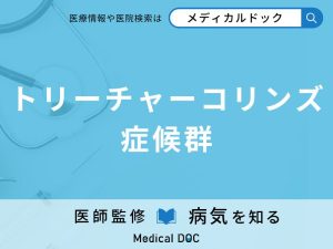トリ―チャーコリンズ症候群