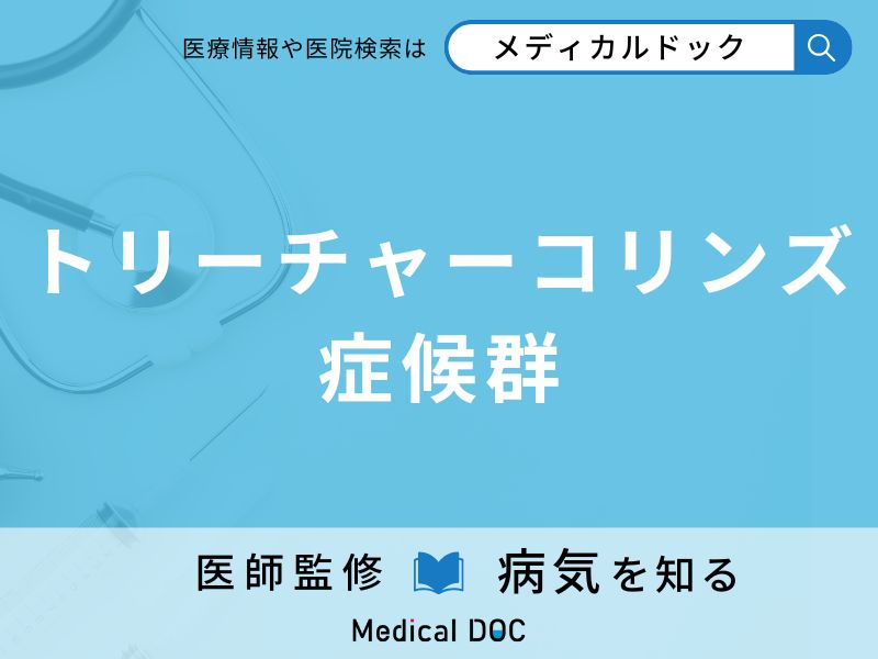 トリーチャーコリンズ症候群