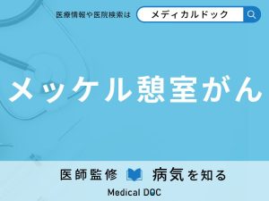 メッケル憩室がん