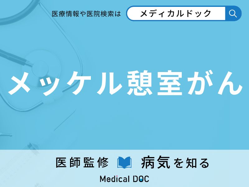 メッケル憩室がん