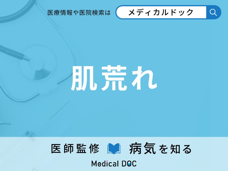 肌荒れ