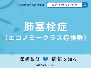 肺塞栓症（エコノミークラス症候群）