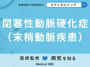 閉塞性動脈硬化症（末梢動脈疾患）