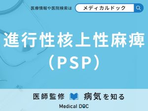 進行性核上性麻痺（PSP）