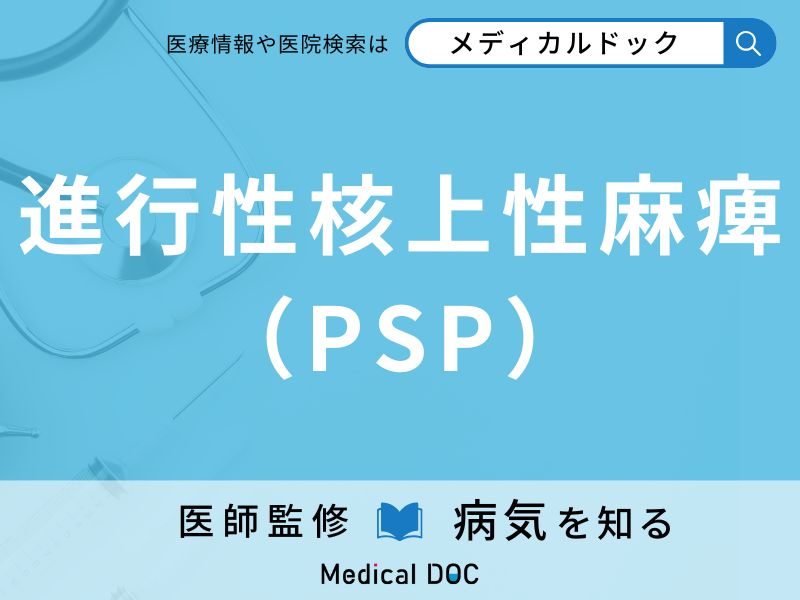 進行性核上性麻痺（PSP）