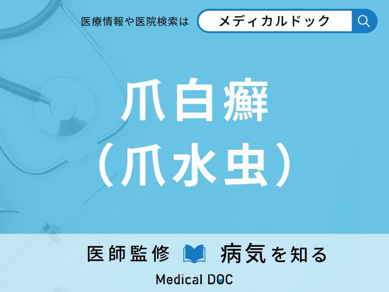 爪白癬（爪水虫）