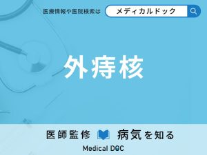 外痔核