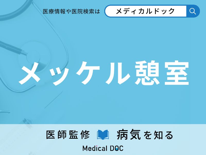メッケル憩室