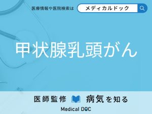 甲状腺乳頭がん