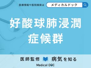 好酸球肺浸潤症候群