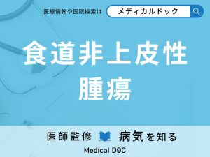 食道非上皮性腫瘍