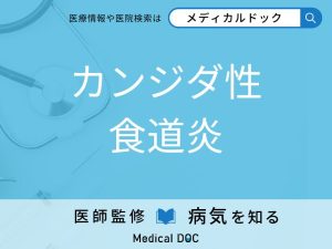 カンジダ性食道炎