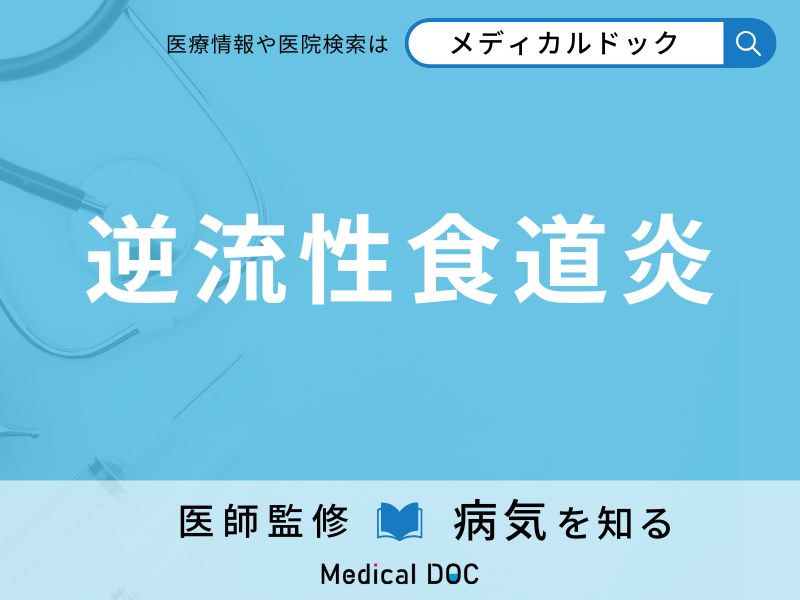 逆流性食道炎