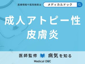 成人アトピー性皮膚炎
