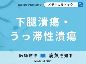 下腿潰瘍・うっ滞性潰瘍の概要