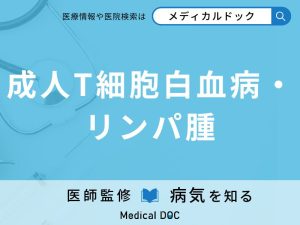 成人T細胞白血病・リンパ腫