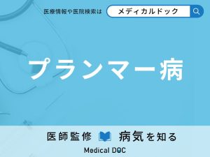 プランマー病