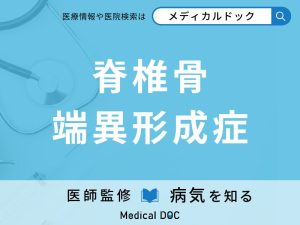 脊椎骨端異形成症