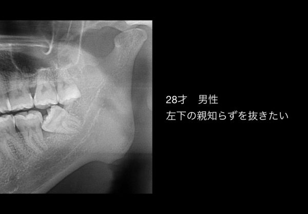 樋口歯科