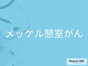 メッケル憩室がん