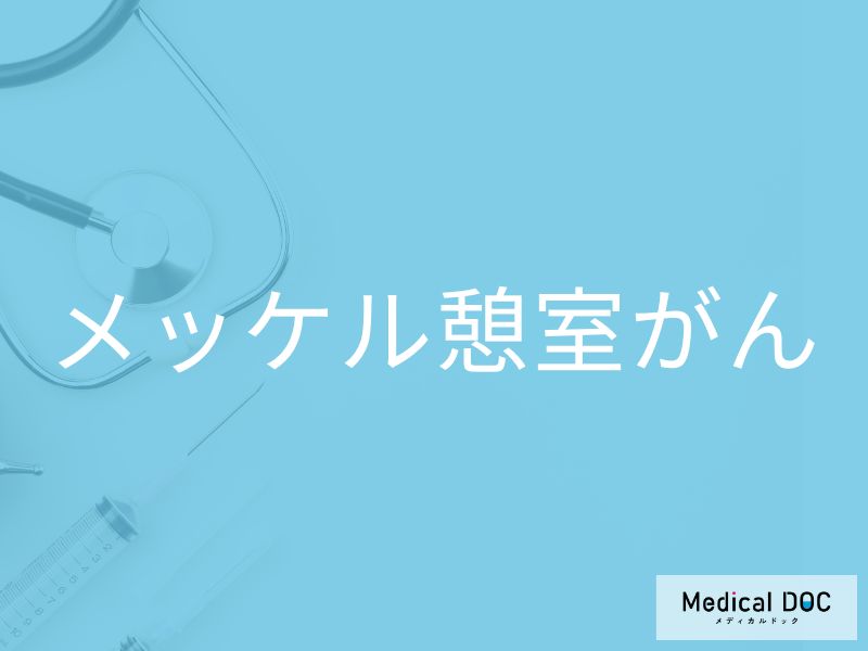 メッケル憩室がん
