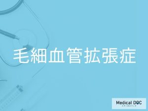 毛細血管拡張症