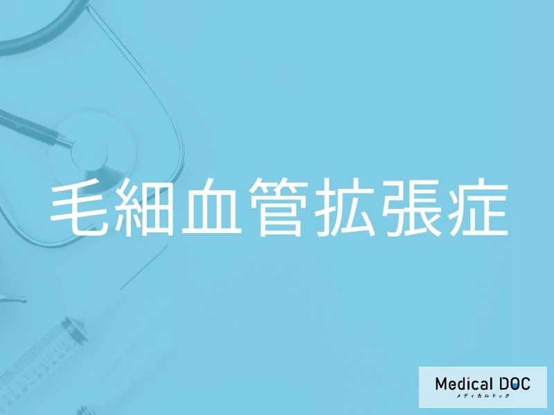毛細血管拡張症