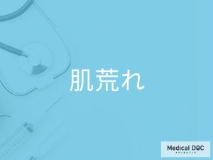 肌荒れ