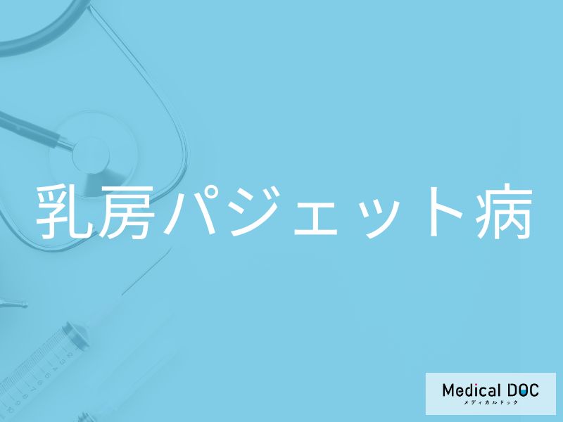 乳房パジェット病