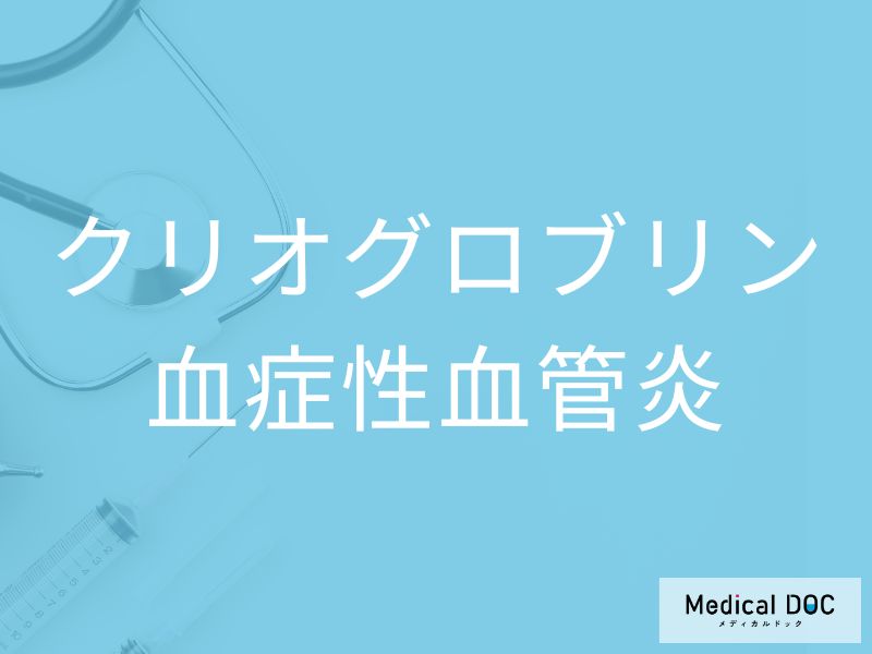 クリオグロブリン血症性血管炎